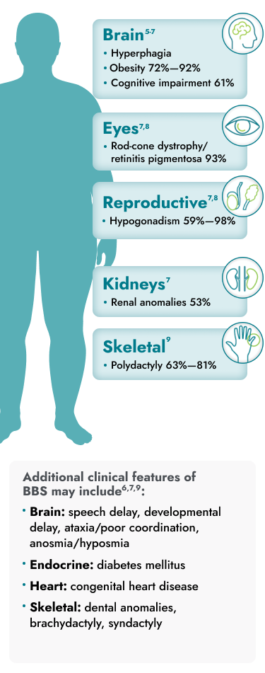 Body diagram identifying BBS symptoms in the brain, kidney, eyes, heart, reproductive, endocrine, and skeletal systems